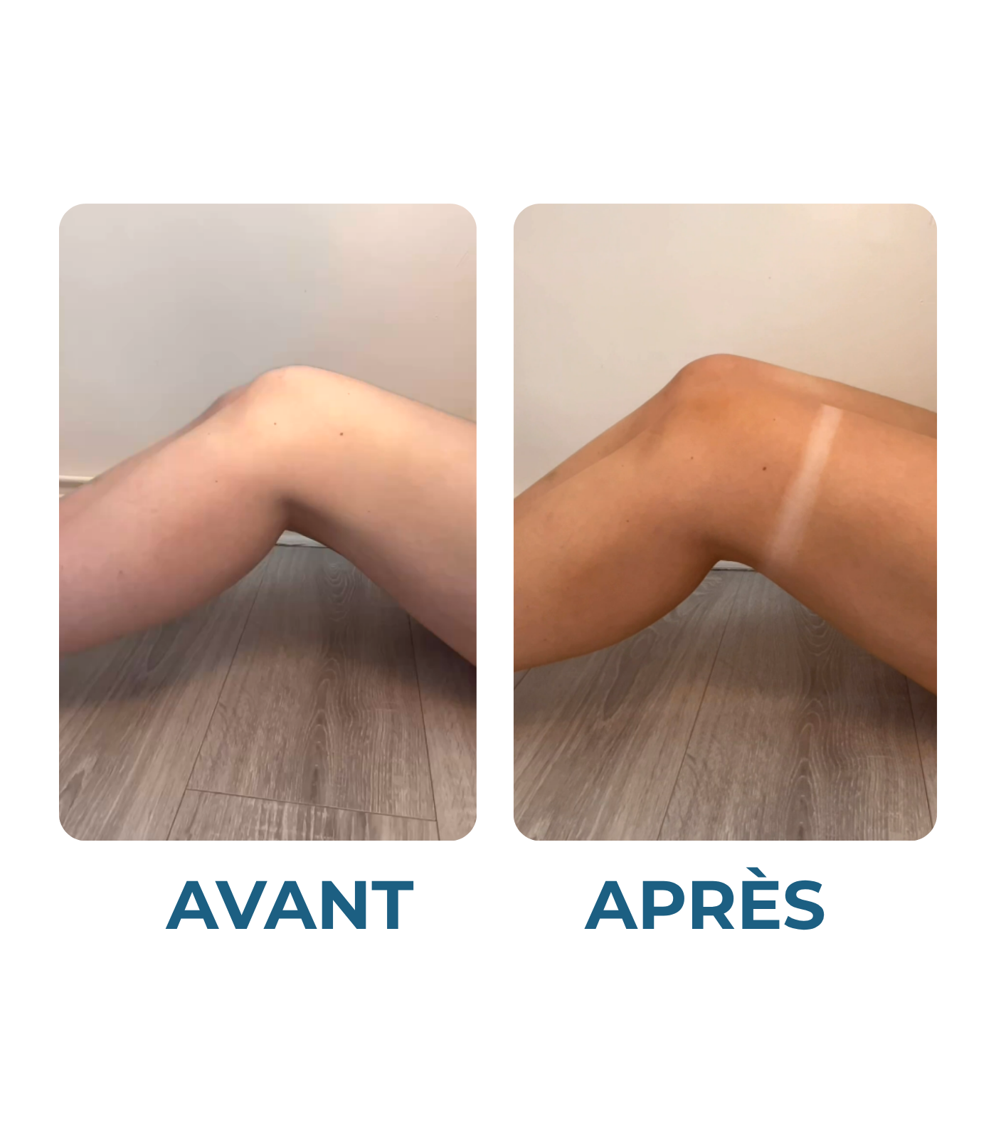 Intense Tinted Self-Tanning Lotion