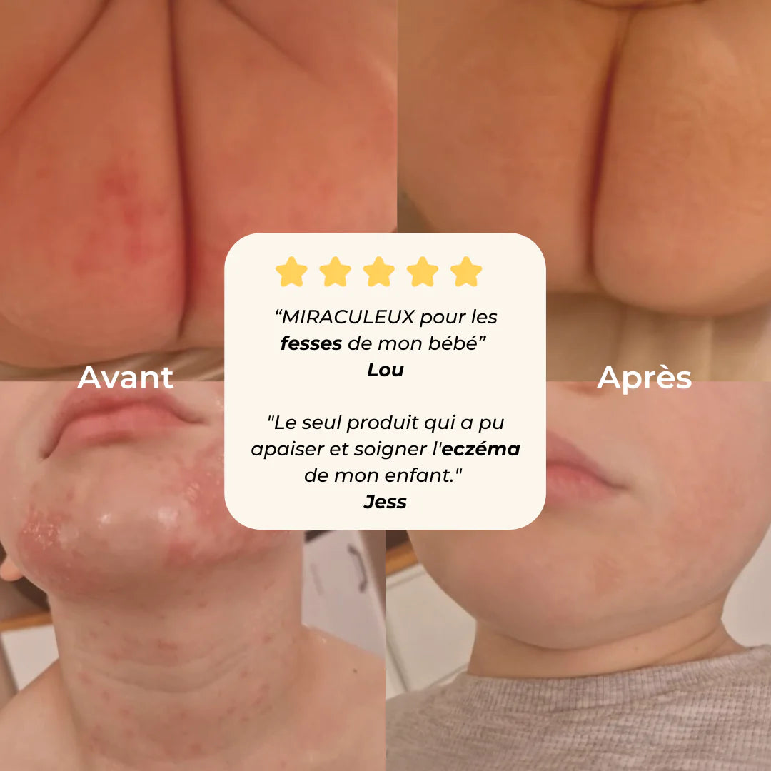 Le Coffret, Bébé