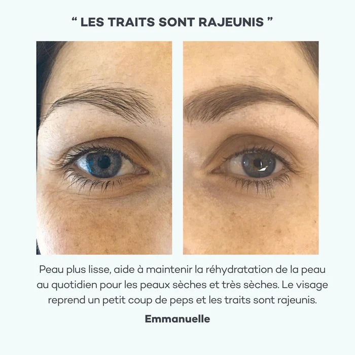 Hyaluronzuur Absoluut