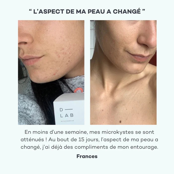 Programme Peau-Parfaite - Peau régénérée, purifiée et matifiée