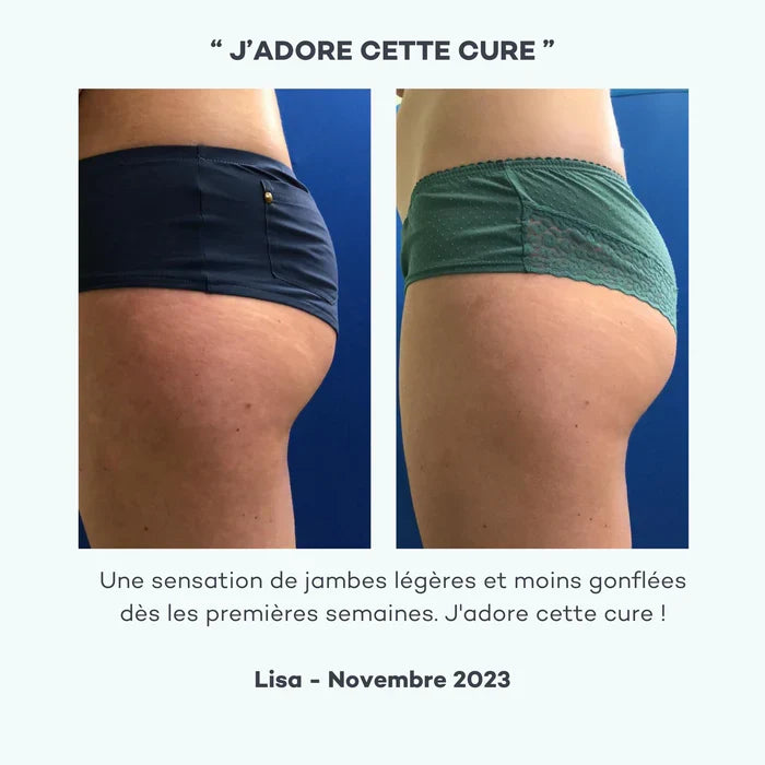 Dimpled-Fat Reduction Program
