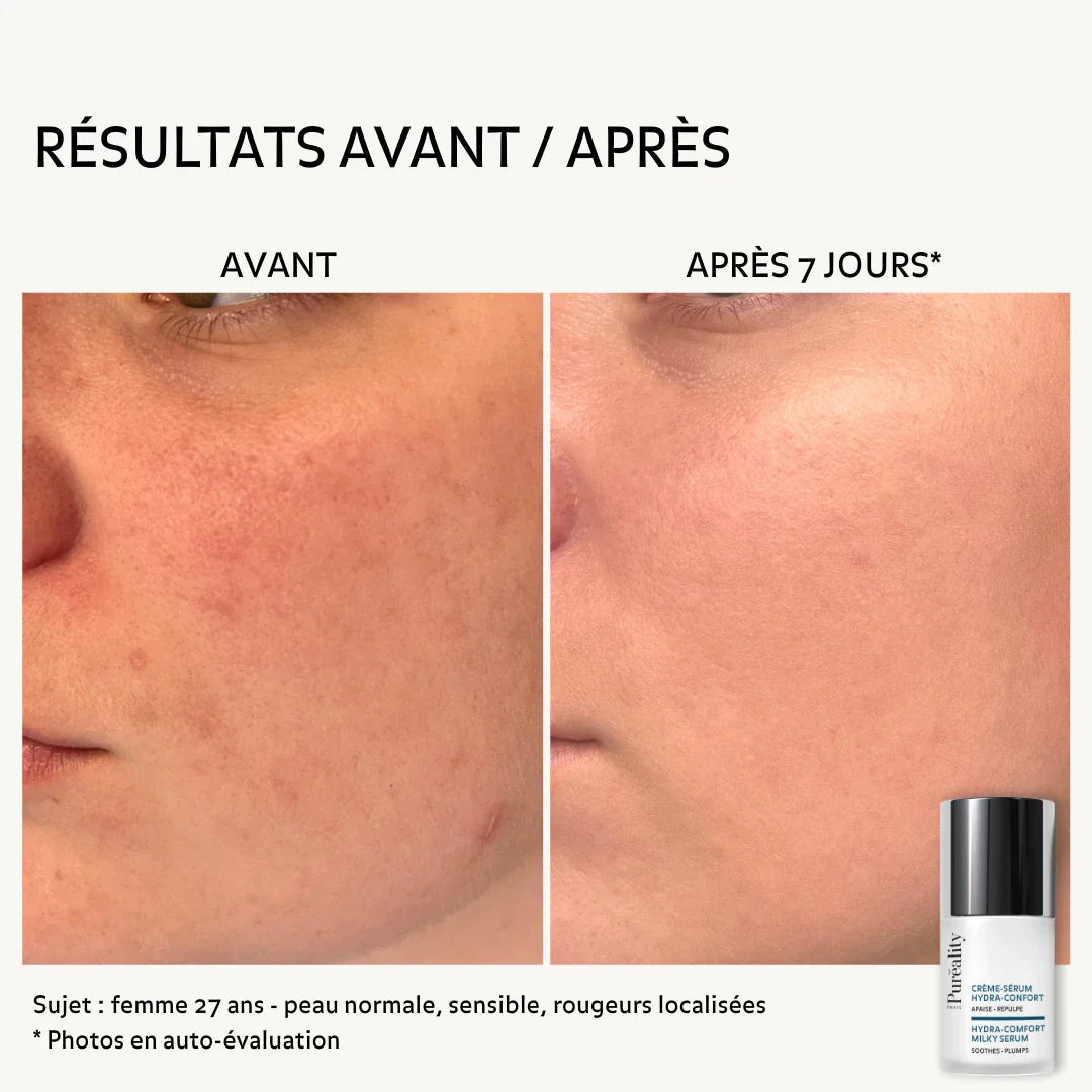 Hydra-Comfort Cream-Serum