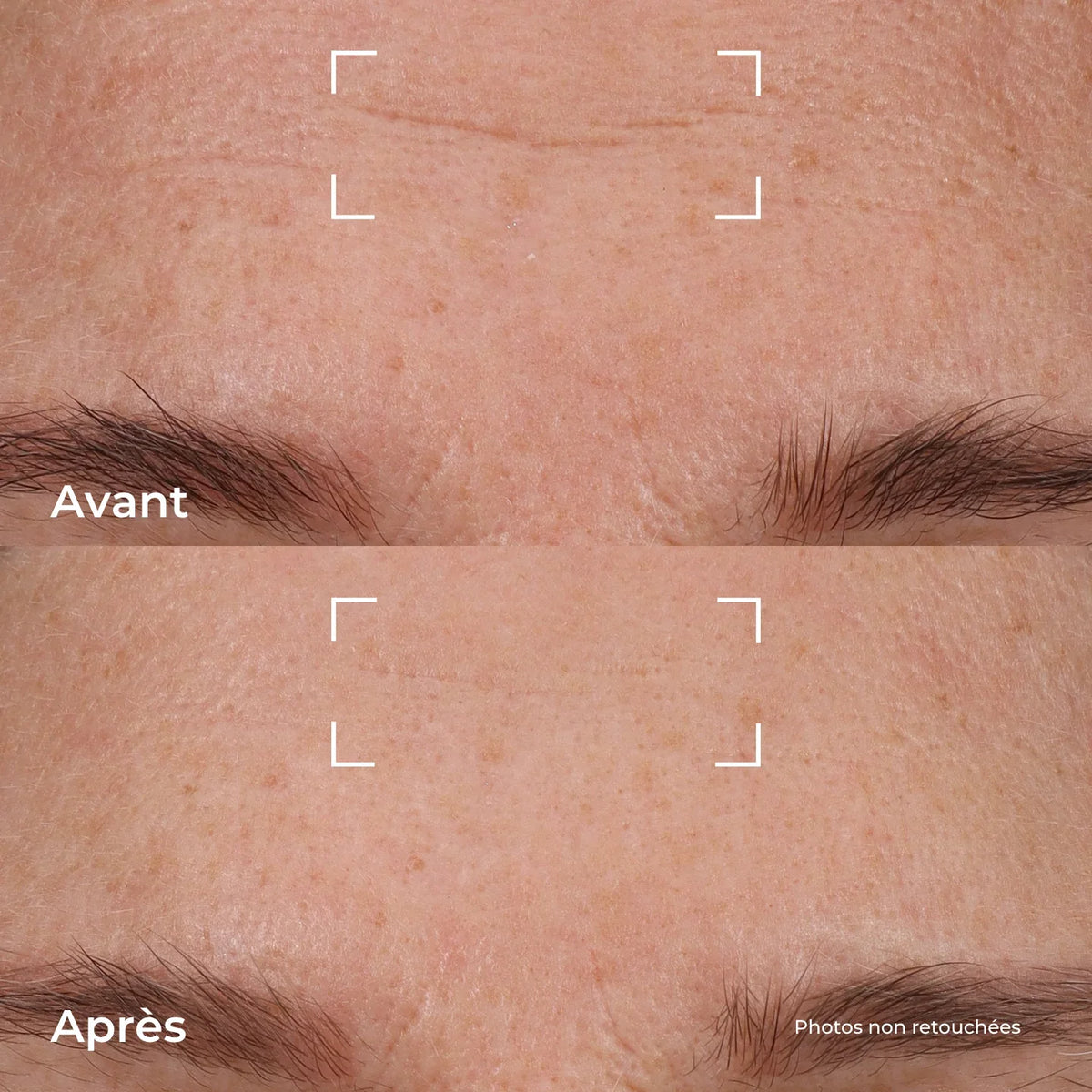 Crème Repulpante Fermeté