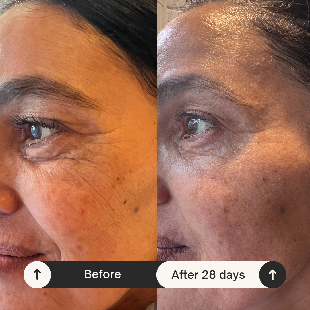 Anti-Blemish Correcting Serum