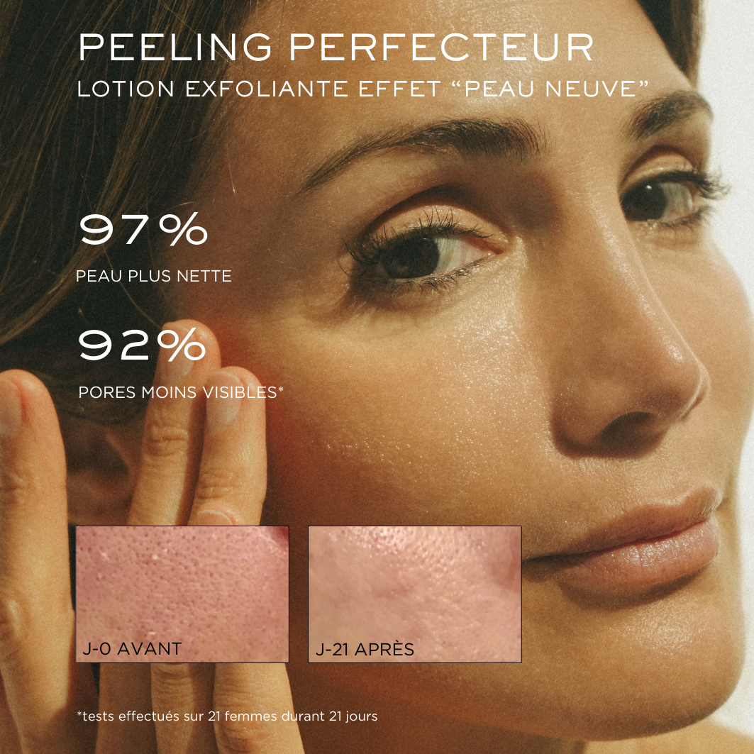 Perfecting Peel