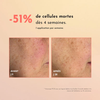 Peeling-Maske