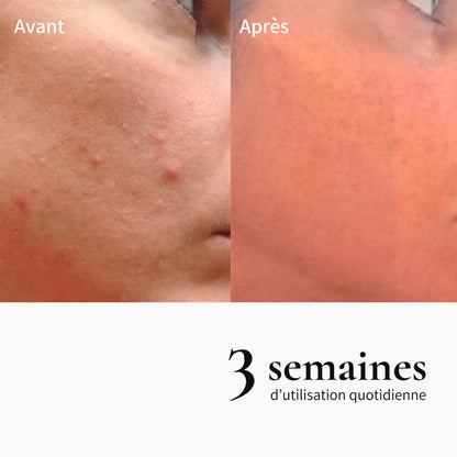 Crème de mousse exfoliante sublimatrice