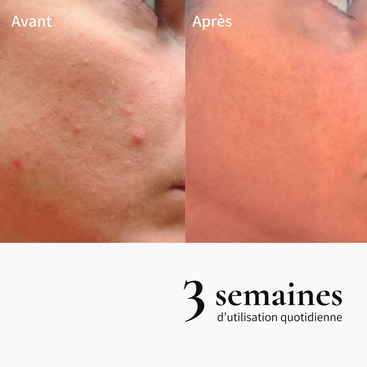 Sublimating exfoliating foam cream