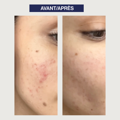 Probiotic Exfoliating Cleansing Gel