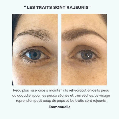 Hyaluronzuur Absoluut