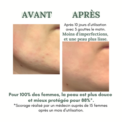 DAY anti-blemish serum