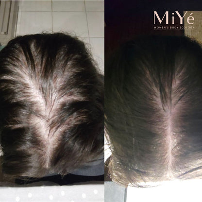 [MY] Anti-Hair Loss Densifying Hair Serum