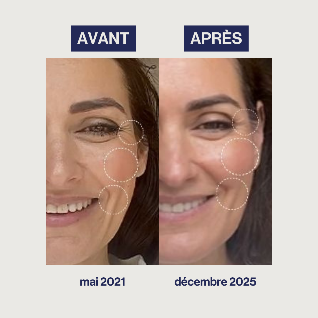 Augmented Collagen - Rides, Fermeté, Élasticité