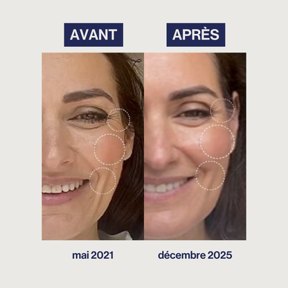 Augmented Collagen - Rides, Fermeté, Élasticité