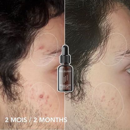 REGULATING SERUM 15ml