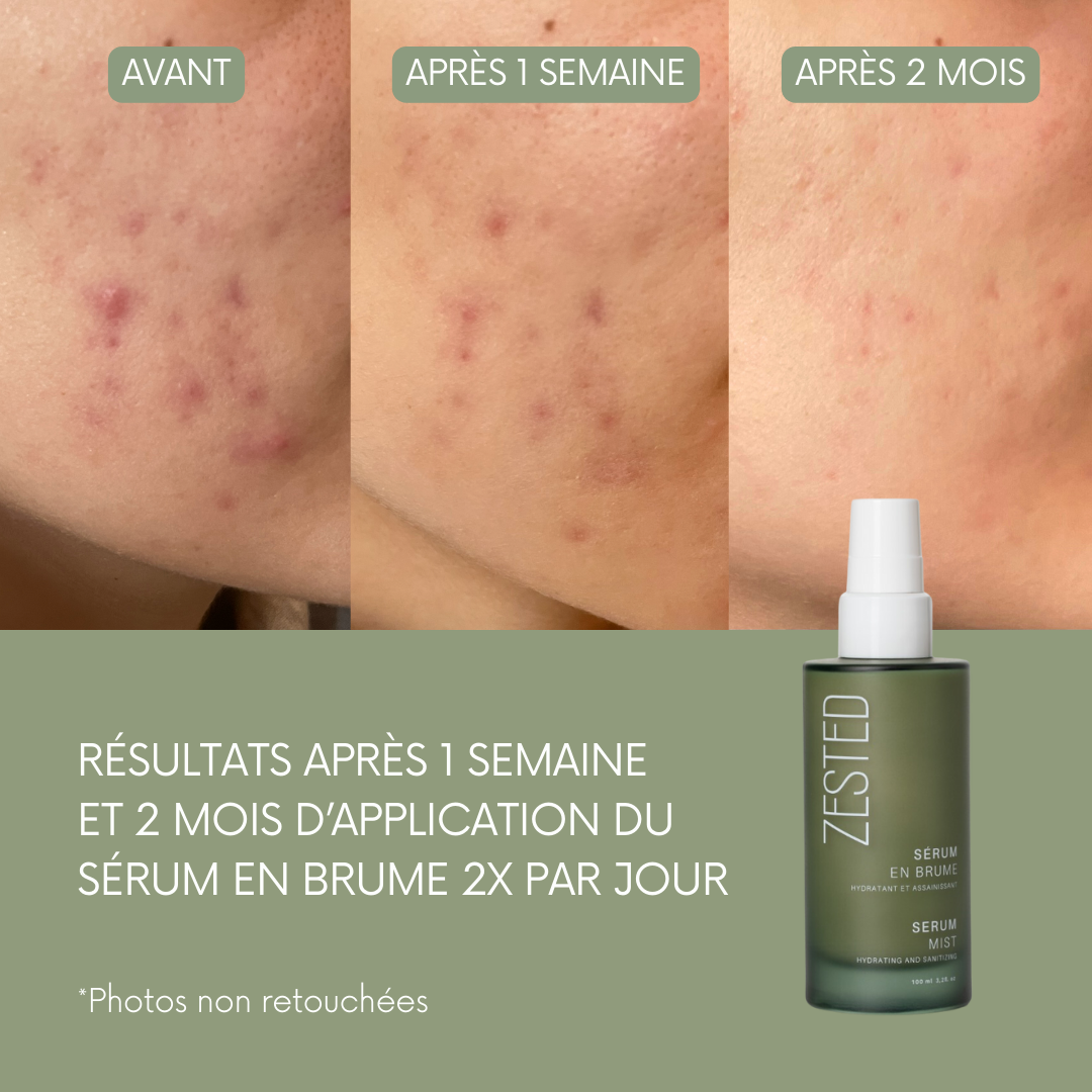 REGENERATING MIST SERUM 100ml