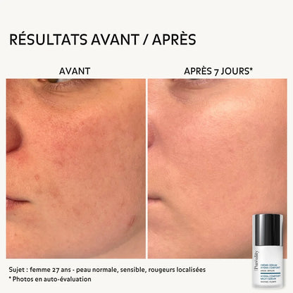 Hydra-Comfort Crème-Serum