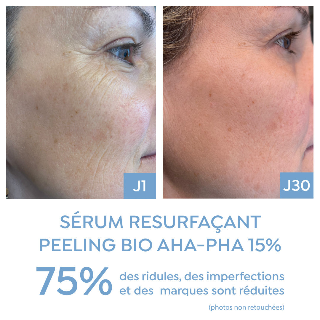Resurfacing Peel Serum AHA-PHA 15%