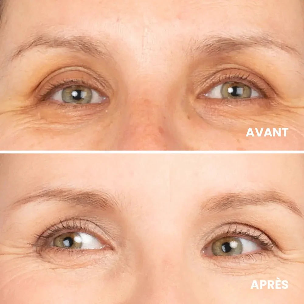 Organic concealer