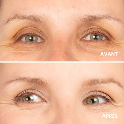 Organic concealer