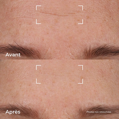 Crème Repulpante Fermeté