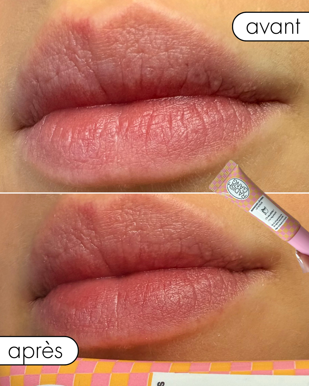 Lips CRUSH box #02