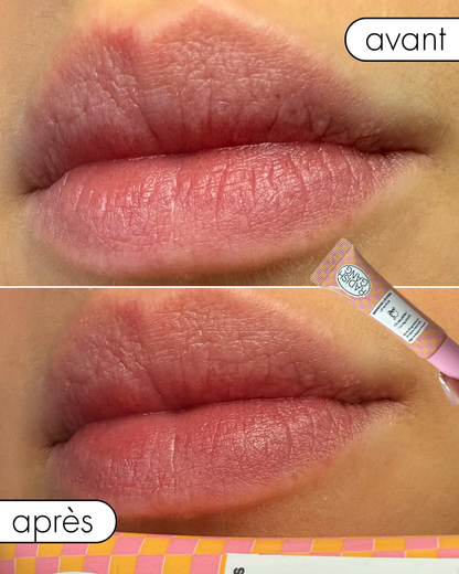 KISS MY PEACH