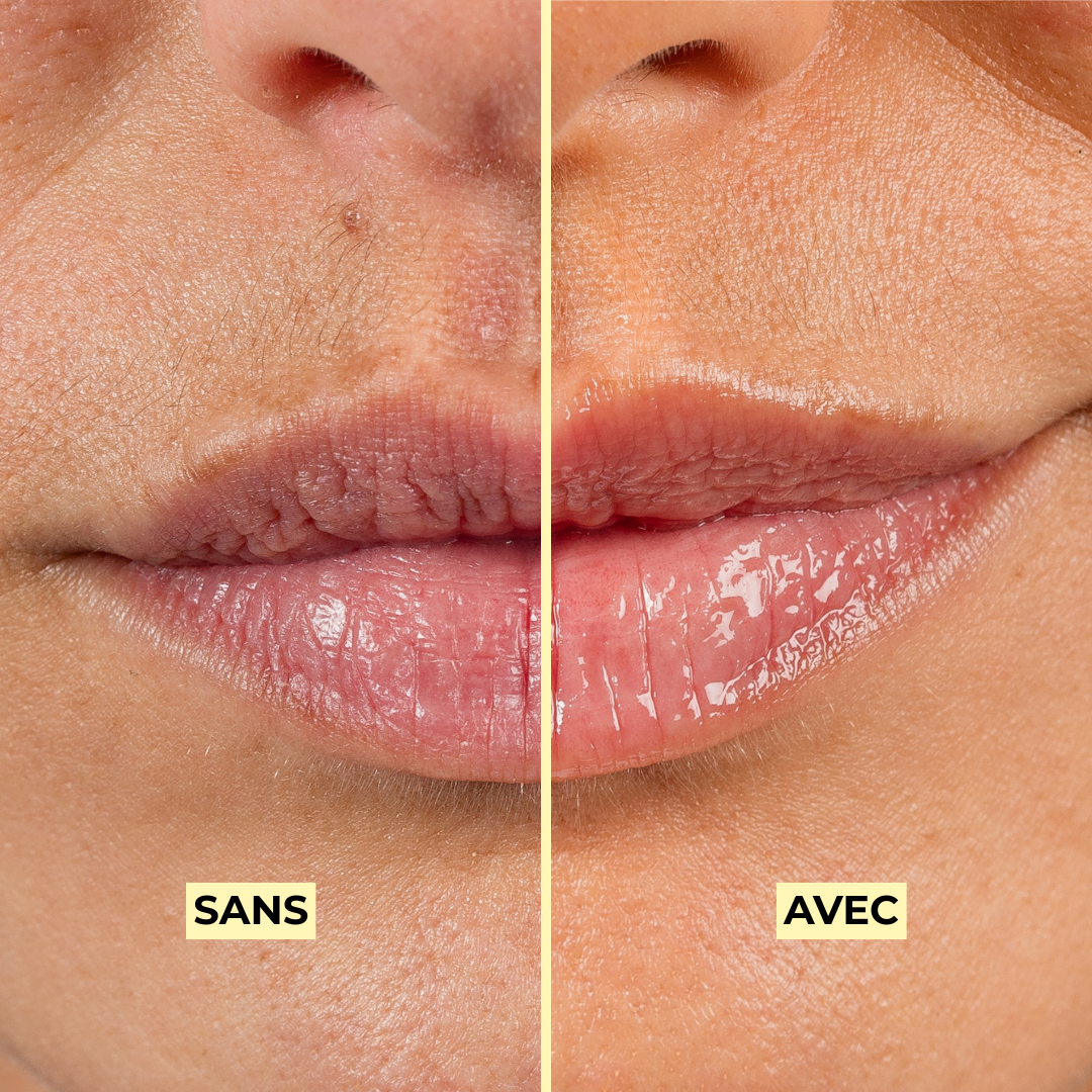 Hydrating lip gloss